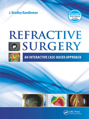 cover image of Refractive Surgery